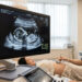 1차 기형아검사 시기